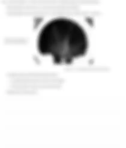 Blurred preview of the question